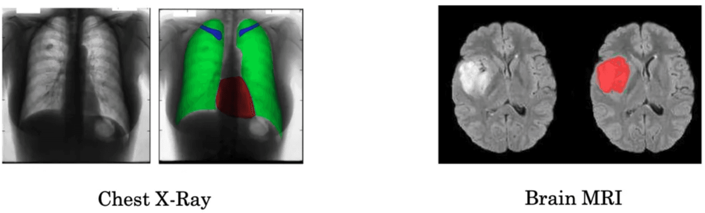 Medical Imaging Example